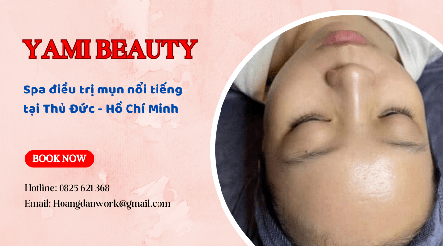 spa điều trị mụn