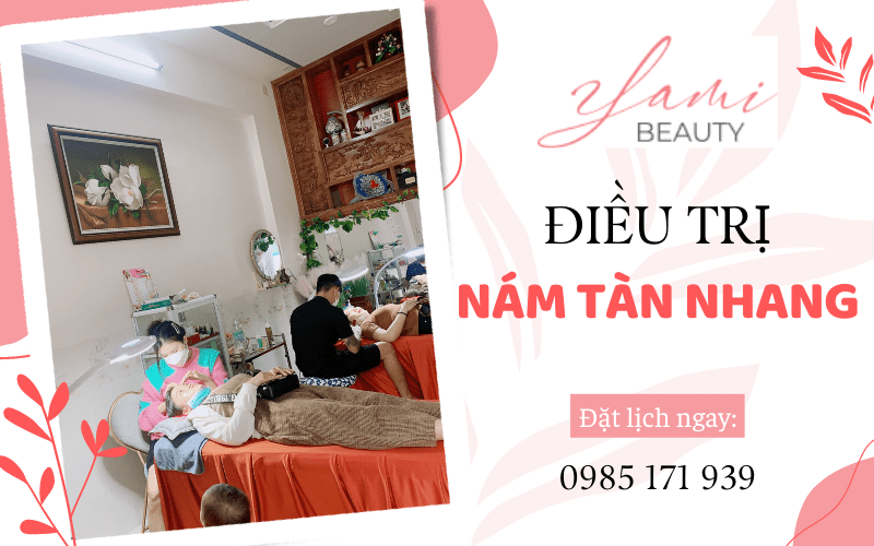 điều trị nám tàn nhang