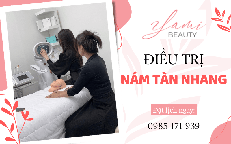 điều trị nám tàn nhang