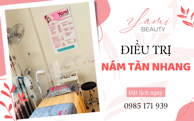 điều trị nám tàn nhang